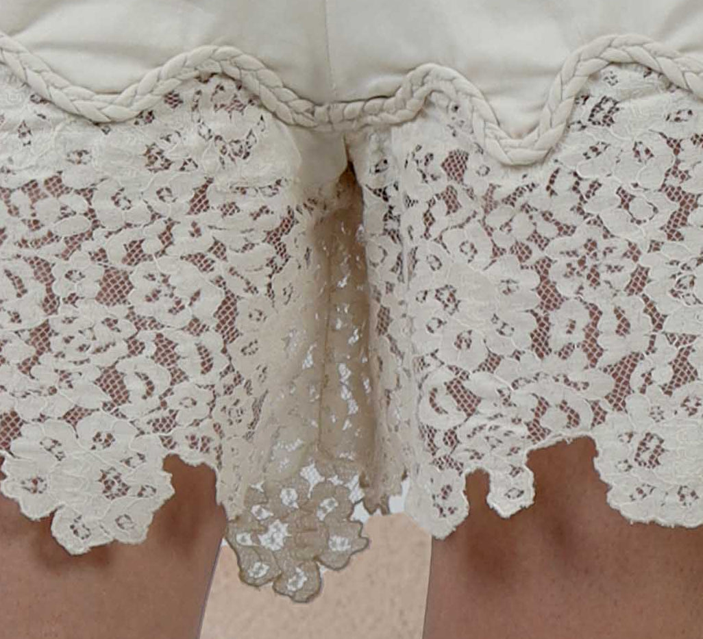 Scalloped lace
